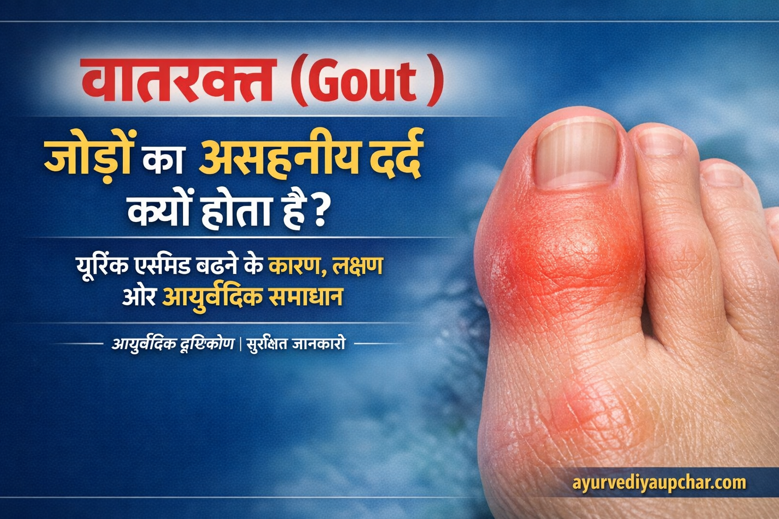 जोड़ों के दर्द की गंभीर बीमारी: वातरक्त (Gout)