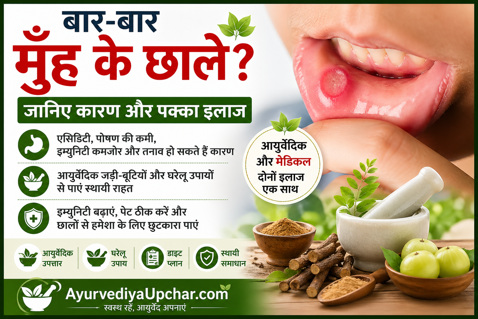 मुँह में बार-बार छाले क्यों होते हैं? कारण, लक्षण और पक्का इलाज