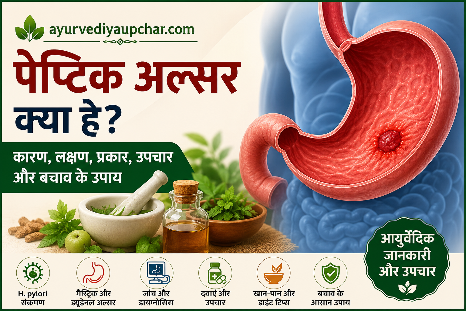 एक आम बीमारी: पेप्टिक अल्सर — कारण, लक्षण, प्रकार, पहचान और उपचार