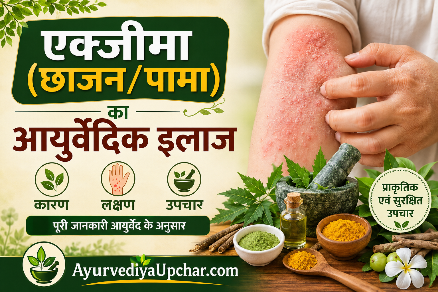एक्जीमा (छाजन/पामा) का आयुर्वेदिक इलाज: कारण, लक्षण और प्रभावी उपचार