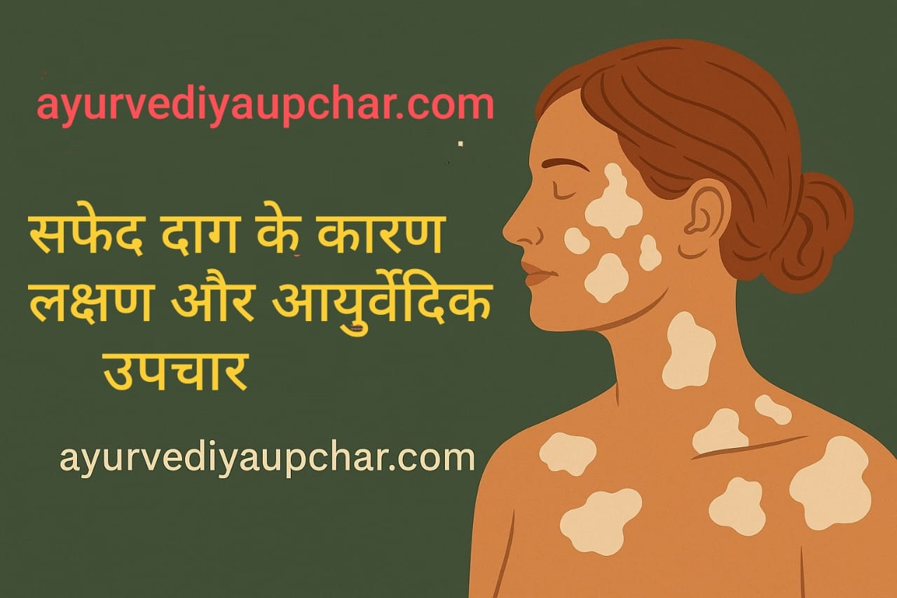 मानसिक रूप से अत्यंत कष्टदायक रोग — सफेद दाग (Vitiligo / Leucoderma)